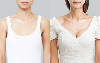 Y шугам үүсгэх хөхний мэс засал