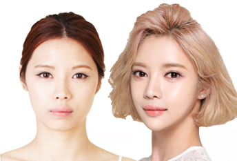 Нүдний доорх цүлхэнг тэгшлэх мэс засал