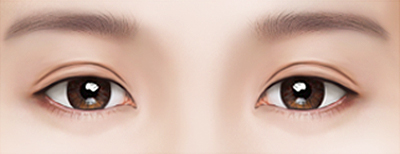 Нүдний давтан мэс засал Давхраа хэт өргөн зузаан сорви ихтэй бол