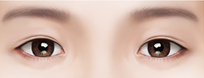 Нүдний давтан мэс засал Нүдэндээ зохиогүй төрөлхийн мэт бус давхраатай бол