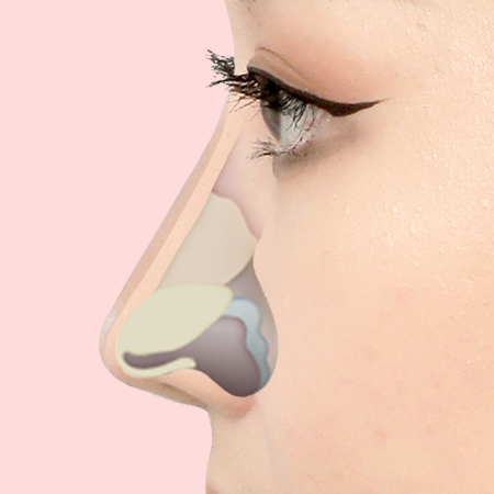 C Point Хамрын үзүүр засах мэс засал Хамрын мөгөөрс