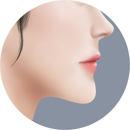 Mini V line Урд эрүүний мэс засал БҮЛТЭН эрүү