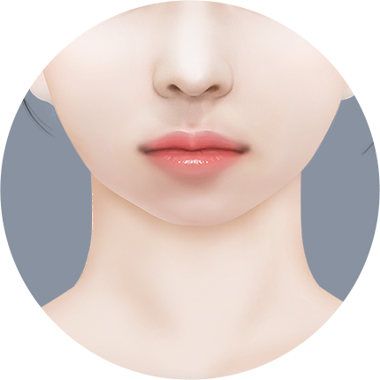 Mini V line Урд эрүүний мэс засал байхгүй эрүү